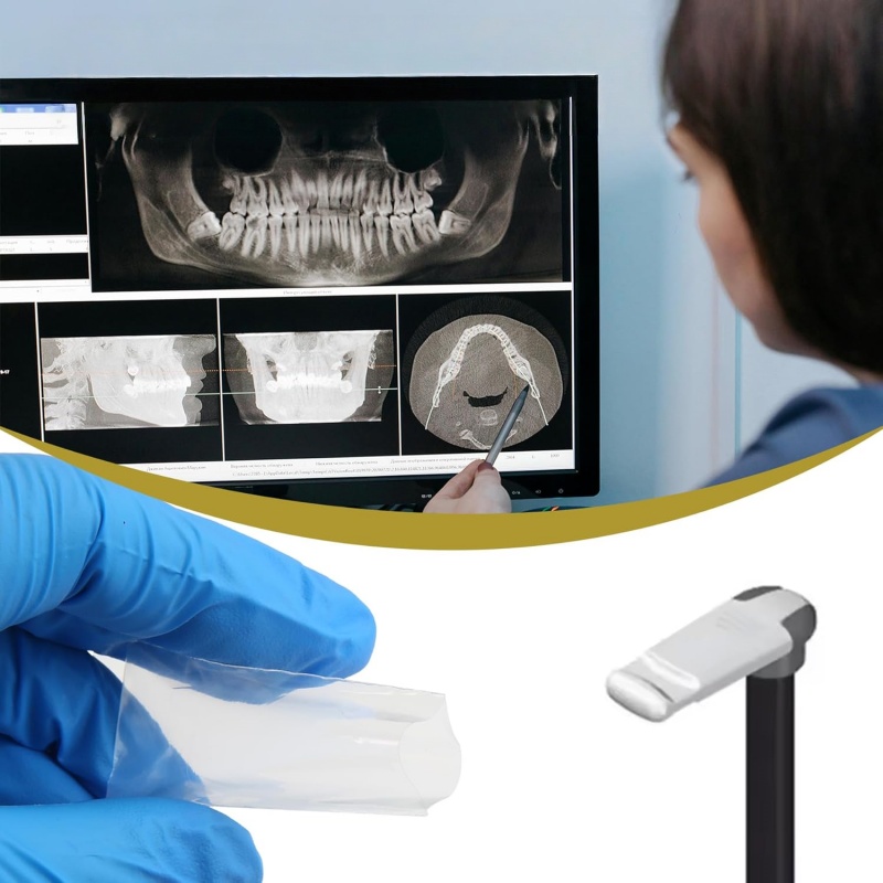 200枚入り/箱 歯科用パノラマバイトブロックカバースリーブ - Photography Dental のレビューと価格