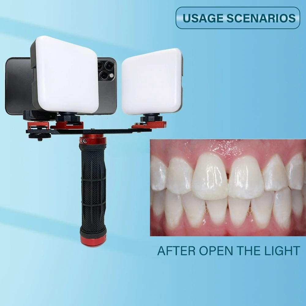 歯科写真撮影ライトフォン、Bluetooth搭載、歯科医師用 - Photography Dental のレビューと価格