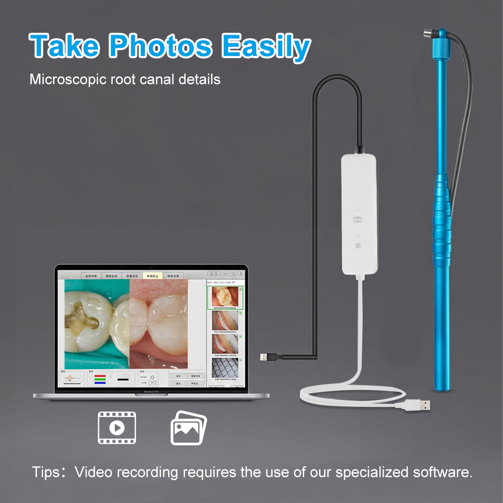 5MPマイクロ口腔内カメラ、歯科用口腔内カメラ、HD USB - Photography Dental のレビューと価格